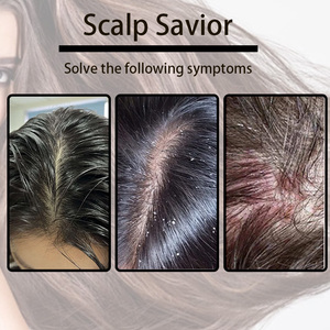 Label pribadi kulit kepala negara, <span class=keywords><strong>Psoriasis</strong></span> bubuk Lyophilized asam salisilat folikulitis minyak seboroic Dermatitis perawatan kulit kepala D - Product Image 6