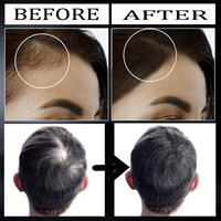 Krim Pertumbuhan Rambut Alami OEM Yedda Anti-Rontok Formula 2-IN-1 Unisex Ekstrak Tumbuhan Organik Perawatan Pertumbuhan Rambut untuk Semua Jenis Rambut