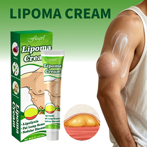 Crema Natural a Base de Hierbas para Eliminar Lipomas, <span class=keywords><strong>Grasa</strong></span> Subcutánea y Nódulos, Ungüento Disolvente de 20g, Crema para el Cuidado de la Piel Corporal, OEM ODM - Product Image 1