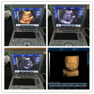 China Portable Notebook Ultrasound 3D 4D Ultrasound Scan Machine Ultrasound Sales SUN-800D
