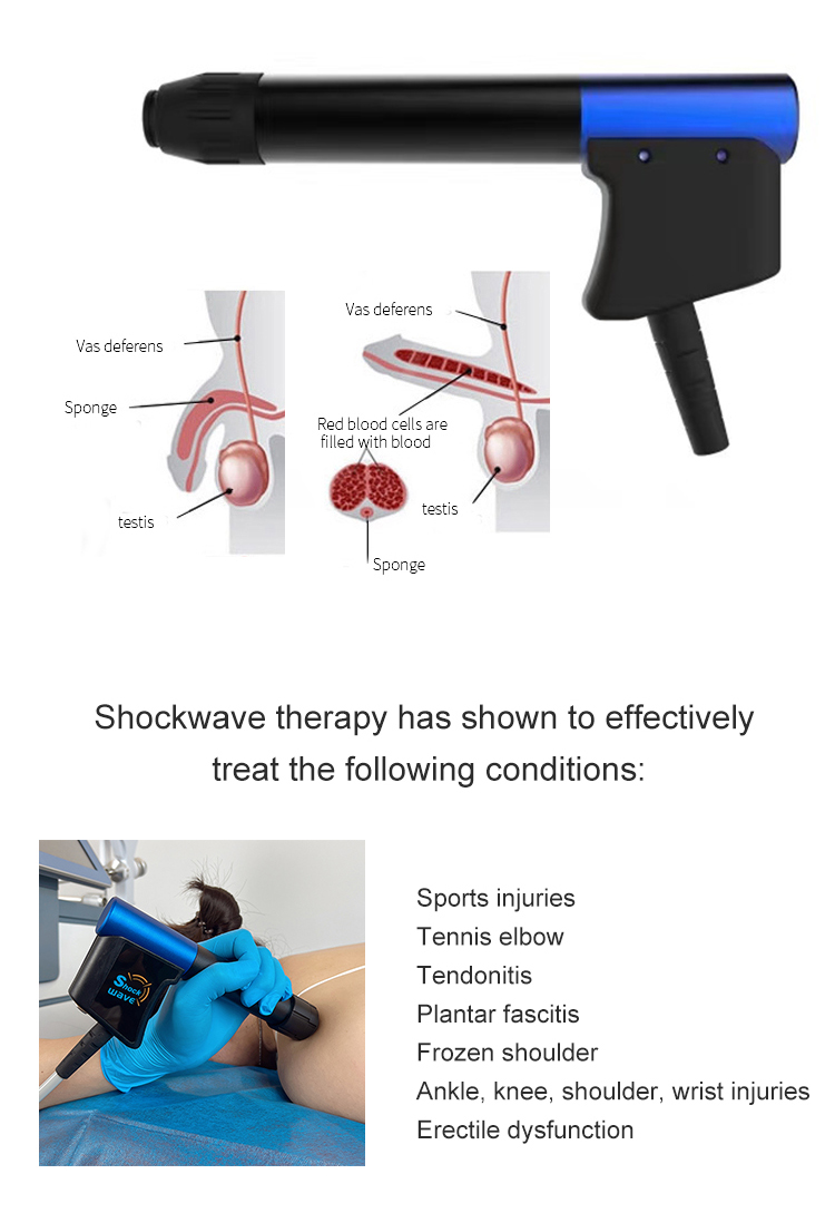 2023 Hot Sale Near Infrared Electric Shock Wave Physical Therapy Emtt Pmst Physio Magneto Therapy Infrared Machine