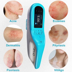 Lampu UV UVB perawatan kulit portabel terbaik, peralatan fototerapi 308nm Excimer Laser Uvb fototerapi untuk <span class=keywords><strong>Psoriasis</strong></span> Vitiligo menyembuhkan - Product Image 6