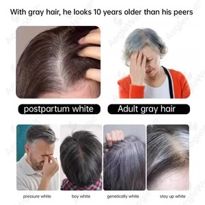 วิตามินเจลลี่เร่งผมยาว Aegelwell OEM ผสมไบโอติน 6 มก., ซิงค์ <span class=keywords><strong>2</strong></span>.<span class=keywords><strong>2</strong></span> มก., คอลลาเจน และโฟเลต เพื่อเล็บแข็งแรง ผิวสุขภาพดี - Product Image 4