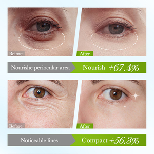 Il nuovo SADOER carbone di bambù collagene idrata stringe maschera per gli occhi idrata paste gli occhi acqua per rimuovere cerchi neri - Product Image 6