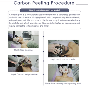 Máquina Picosend para Eliminación de Tatuajes, Máquina Pico para Eliminación de Cejas, Limpieza Profunda Facial, Eliminación de Acné, <span class=keywords><strong>Precio</strong></span> - Product Image 4