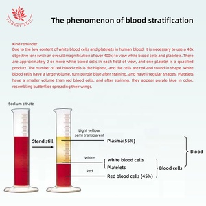 Microscópio Biológico para Imagem de Sangue Humano: Eritrocitos e Leucócitos – Seção de Amostra Clara e Fácil de Observar - Product Image 4