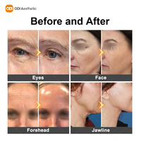 Appareil de lifting facial magnétique EMssings, machine de raffermissement de la peau, anti-rides, machine de rajeunissement du visage, appareil anti-âge