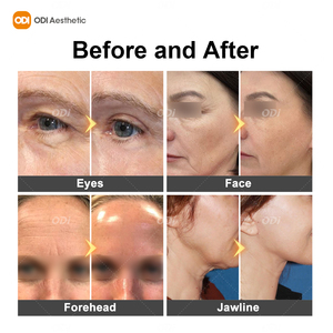 <span class=keywords><strong>Appareil</strong></span> de lifting facial magnétique EMssings, machine de raffermissement de la peau, <span class=keywords><strong>anti</strong></span>-rides, machine de rajeunissement du <span class=keywords><strong>visage</strong></span>, <span class=keywords><strong>appareil</strong></span> <span class=keywords><strong>anti</strong></span>-âge - Product Image 6