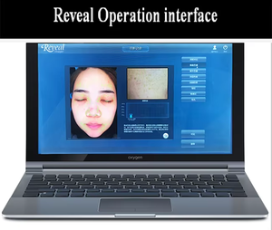 Analyseur <span class=keywords><strong>de</strong></span> peau 3D DS-36 avec fonctions <span class=keywords><strong>de</strong></span> soin <span class=keywords><strong>de</strong></span> la peau pour usage domestique et commercial - Product Image 3