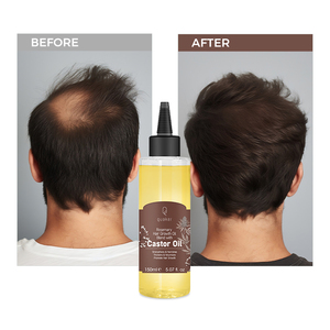 Qquaker <span class=keywords><strong>Aceite</strong></span> <span class=keywords><strong>De</strong></span> Romero Para El Crecimiento Del Cabello <span class=keywords><strong>Aceite</strong></span> <span class=keywords><strong>De</strong></span> <span class=keywords><strong>Ricino</strong></span> <span class=keywords><strong>Aceite</strong></span> <span class=keywords><strong>De</strong></span> Crecimiento Del Cabello Para Hombres <span class=keywords><strong>Aceite</strong></span> <span class=keywords><strong>De</strong></span> Cabello Orgánico - Product Image 5