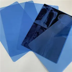 Medische X-Ray Droge Blauwe Film 14X17 A4 A3 Grootte Voor Inkjetprinter