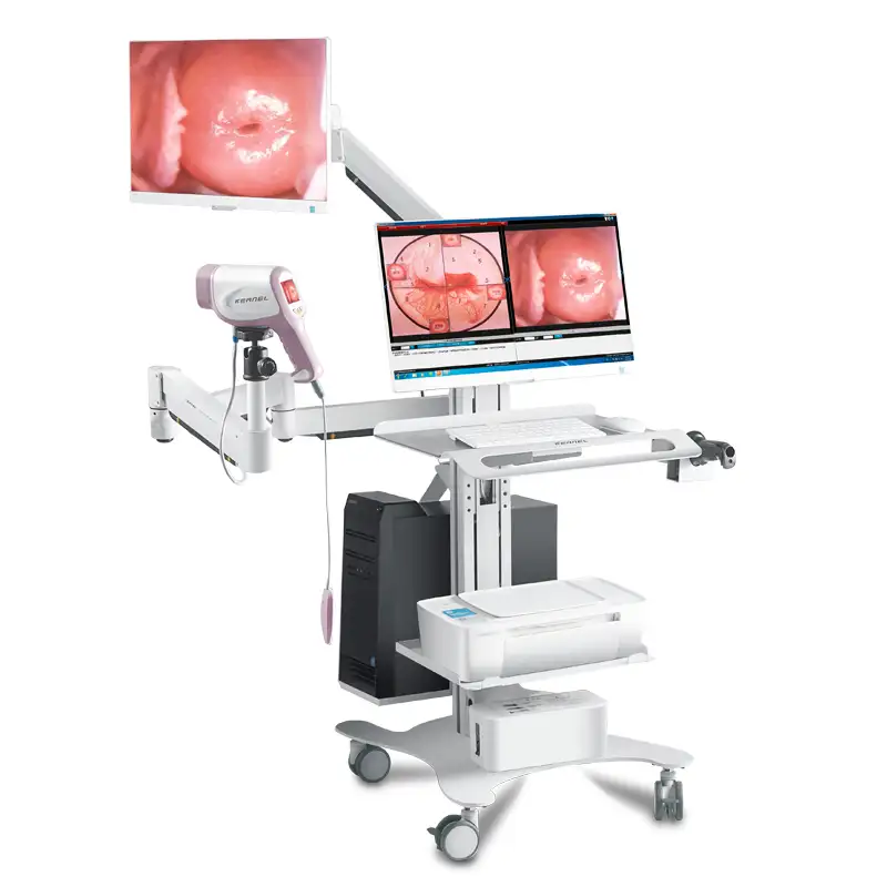 KN-2200I colposcopio видео цифровой HD кольпоскоп для гинекологии предварительно окрашенная оцинкованная сталь) с низкой ценой 1080P