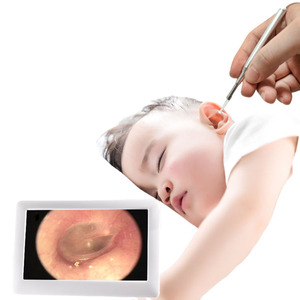 Cámara endoscópica de otoscopio de video HD con limpiador de oídos ligero - Product Image 3