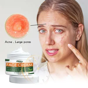 Mặt Trăng phía Nam BHA axit salicylic vitamin dầu cây trà Mặt kem mụn trứng cá vết sẹo điều trị viêm da tiết bã Mặt Kem cho phụ nữ