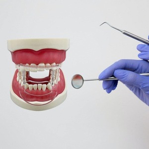 Abrebocas Dental, 5 Piezas, Retractor de Labios y Mejillas Transparente para Ortodoncia, Accesorio Bucal para Dientes Anteriores - Product Image 6