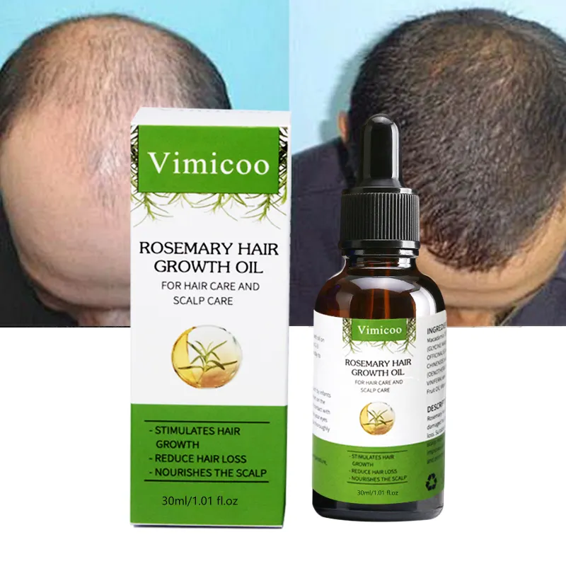 Aceite nutritivo natural para el cuidado del cabello, aceite esencial para reparar el cuero cabelludo, iluminar y reducir la pérdida de cabello, aceite para el crecimiento del cabello de Romero