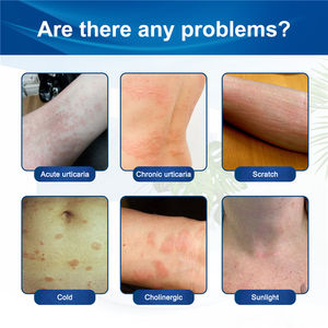 Crème contre l'urticaire South Moon, inhibe les bactéries, soulage les démangeaisons, prévient les piqûres de moustiques, répare les égratignures, crème onguents - Product Image 5