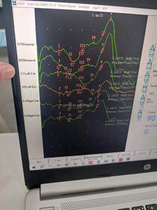 Système EMG KT-H014 2/4/8 canaux, appareil EMG, électromyographie pour diagnostic clinique et diagnostic différentiel - Product Image 5