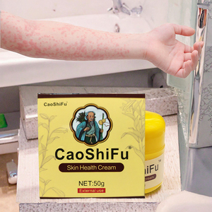 Caoshifu 50g Cerotto Naturale a Base di Erbe Cinesi Crema Anti-Prurito per la Cura della Pelle Efficace su Dermatite Eczema Orticaria <span class=keywords><strong>Desquamazione</strong></span> - Product Image 3