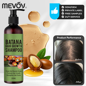 OEM OBM croissance des cheveux bio huile de coco avocat perte de cheveux <span class=keywords><strong>shampooing</strong></span> et après-<span class=keywords><strong>shampooing</strong></span> à la biotine <span class=keywords><strong>shampooing</strong></span> au vinaigre de cidre de pomme - Product Image 1