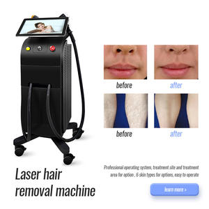 Professionnel Nova 3000w 755nm 808nm 1064nm 940nm Kiers Inmode 3 Longueur D'onde Diode Laser Épilation Machine Prix 4000w - Product Image 5