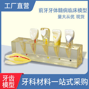 Modelo de Pulpa Dental Anterior con Pulpitis, Modelo de Enseñanza Dental Clínico Patológico, Equipo y Accesorios - Product Image 5