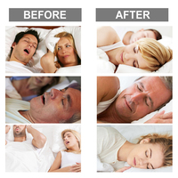 South Moon 1pc Anti-Ronflement : Embout buccal universel pour adultes, personnes âgées et enfants – Dispositif anti-ronflement efficace
