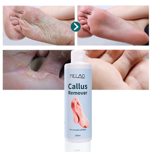 Tea Tree professionale olio di rimozione calli Gel Extra forza Peeling del piede <span class=keywords><strong>crema</strong></span> per il tallone incrinato esfoliante cura del piede - Product Image 3
