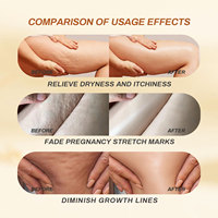 Huile de massage anti-cellulite OEM/ODM, raffermissante, modelante, lissante pour peaux rugueuses, drainage des toxines, raffermissant la peau flasque, hydratant, soin amincissant du corps