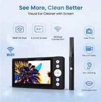 Caméra otoscope numérique HD avec écran, outil d'inspection rechargeable pour l'élimination visuelle du cérumen, endoscope pour la maison, la clinique et les animaux de compagnie