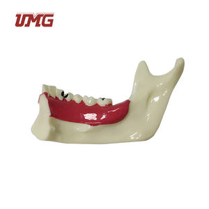 Modello di decomposizione dentale organizzazione modello di mandibola Od - Product Image 3
