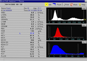 Vendita calda di alta qualità laboratorio <span class=keywords><strong>3</strong></span> parte analizzatore ematologico completamente automatizzato cbc mac - Product Image 4
