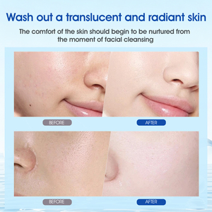 Limpiador Facial Clarificante <span class=keywords><strong>de</strong></span> Poros Profundos con Levadura Orgánica Personalizada, Reafirmante, con Aceite <span class=keywords><strong>de</strong></span> <span class=keywords><strong>Coco</strong></span> y Ácido Hialurónico para Todo Tipo <span class=keywords><strong>de</strong></span> Piel - Product Image 5