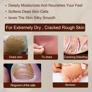 Eelaze-espray <span class=keywords><strong>para</strong></span> el cuidado <span class=keywords><strong>de</strong></span> los pies, eliminador <span class=keywords><strong>de</strong></span> olores, purificador orgánico Natural - Product Image 6