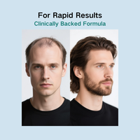 OEM/ODM | Formule de croissance des cheveux de qualité supérieure avec biotine et bloqueur d'Ashwagandha-DHT pour des cheveux plus épais et plus épais