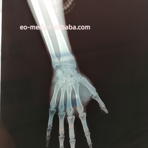 CE Approval Cheapest Price Digital X-ray Film Inkjet <b>Printer</b> With Split Cartridge XP02 - Product Image 5