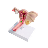 Modèle d'enseignement médical de l'utérus féminin et de l'anatomie de l'ovaire Modèle anatomique pathologique de l'utérus