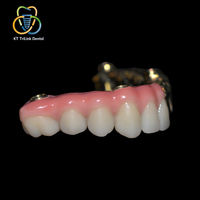 Porcelaine esthétique pour gencives, céramique rose pour implant dentaire, couronne, pont, prothèse, simulation de tissus mous