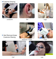 MDSAP NOUVEAU Appareil Laser Diode 1200W à 4 Têtes Interchangeables pour Épilation Permanente Indolore avec Refroidissement Semi-conducteur