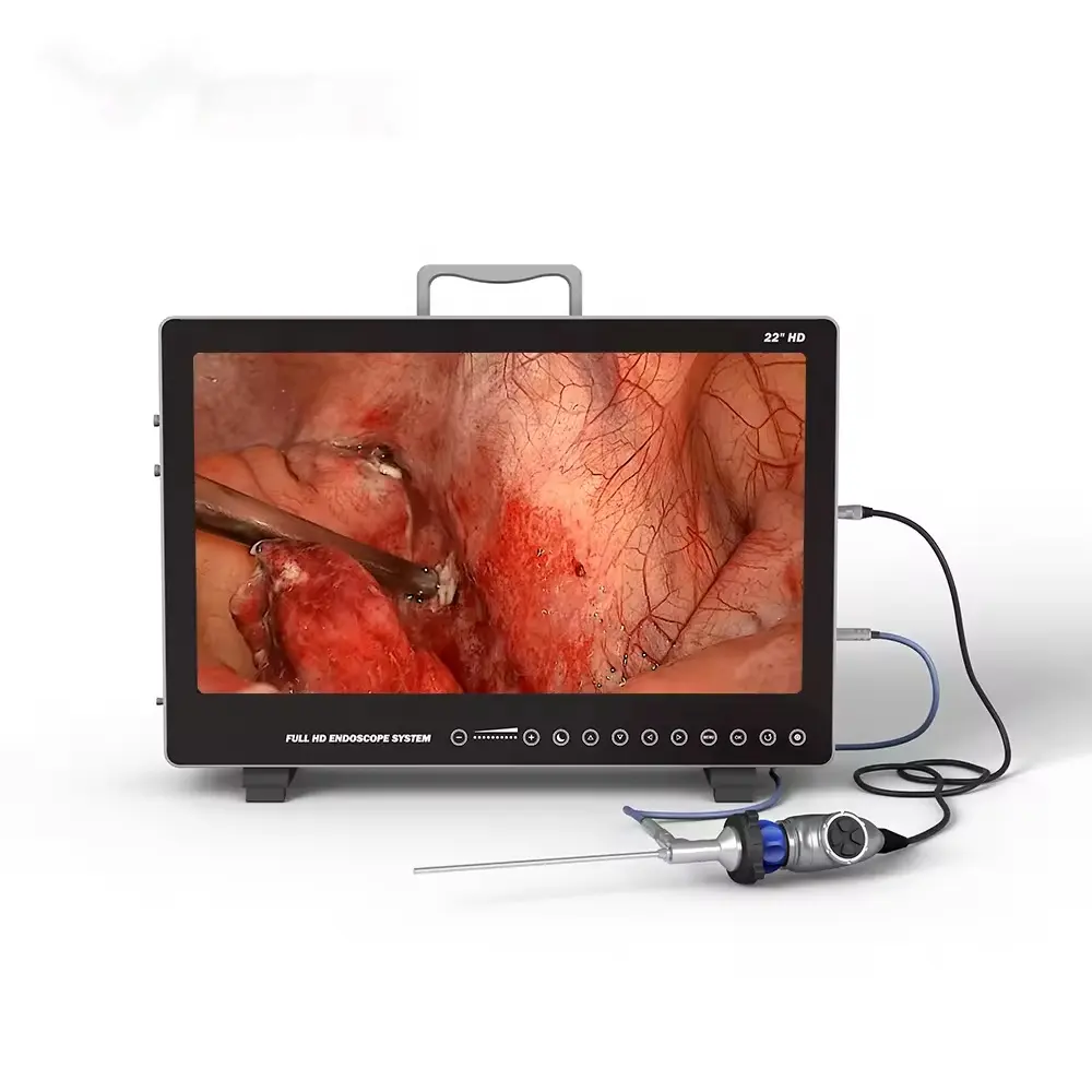 Hot selling full HD endoscope system portable endoscope camera