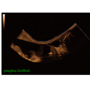 Sistema de Ultrasonido Veterinario <span class=keywords><strong>Mindray</strong></span> M6Vet Plateado, Enchufe Eléctrico de Acero para Mascotas Pequeñas - Product Image 3