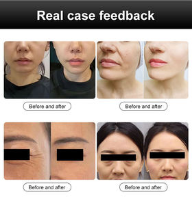 Appareil de raffermissement 360 Energy deux-en-un multi-prises, équipement de beauté pour usage domestique transfrontalier - Product Image 5