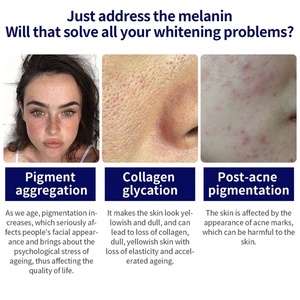 Suero de Ácido Hialurónico al por Mayor de 30 ml para el Cuidado Facial, Solución Correctora para la Eliminación de Manchas Oscuras - Product Image 3