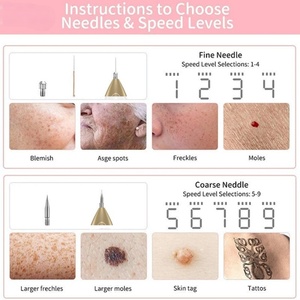 Advanced Electronic Mole <b>Remover</b> ABS Material USB Charging Pen for Targeted Skin Treatment - Product Image 5