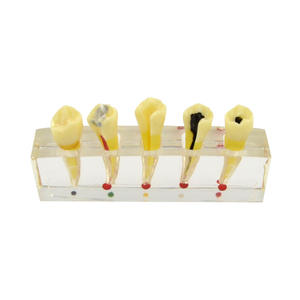 Chambre à pulpe amovible et système de <span class=keywords><strong>canal</strong></span> radiculaire pour la pratique de la pathologie de l'école dentaire avec modules de lésion périapicale - Product Image 5