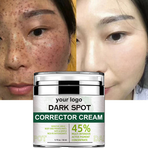 Blanchiment fort blanchissant visage <span class=keywords><strong>taches</strong></span> de rousseur supprimer crème correctrice boutons Melasma élimination des imperfections crème <span class=keywords><strong>anti</strong></span>-<span class=keywords><strong>taches</strong></span> sombres - Product Image 2