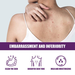 Eelhoe เจลสำหรับขัดผิวลาเวนเดอร์-เจลล้างหน้าคืนความอ่อนเยาว์ให้<span class=keywords><strong>หลัง</strong></span>เป็น<span class=keywords><strong>สิว</strong></span>สครับเพื่อปรับปรุงผิวหมองคล้ำ - Product Image 2