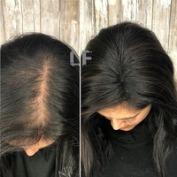 LONGFOR 100% Cheveux Humains Chinois Femmes Topper Base de Soie Cheveux Humains Toupet