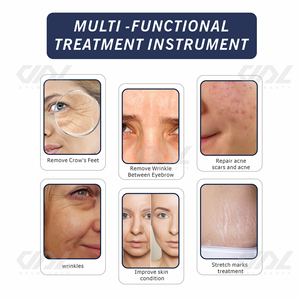 Meilleur Appareil de <span class=keywords><strong>Micro</strong></span>-Aiguilletage Fractionnel RF de Bureau, <span class=keywords><strong>Radiofréquence</strong></span> Dorée, Marteau Froid, Équipement de Beauté Anti-Rides pour Salon - Product Image 6