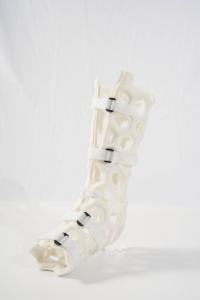 Ademende En Waterdichte Orthesen Externe Fixatiebeugels Voor Klinisch Gebruik Tibia/Fibula/Enkelbreuken-Verstelbaar Ontwerp - Product Image 5